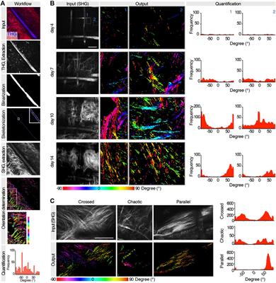 Deep Learning for Automated Analysis of Cellular and Extracellular Components of the Foreign Body Response in Multiphoton Microscopy Images